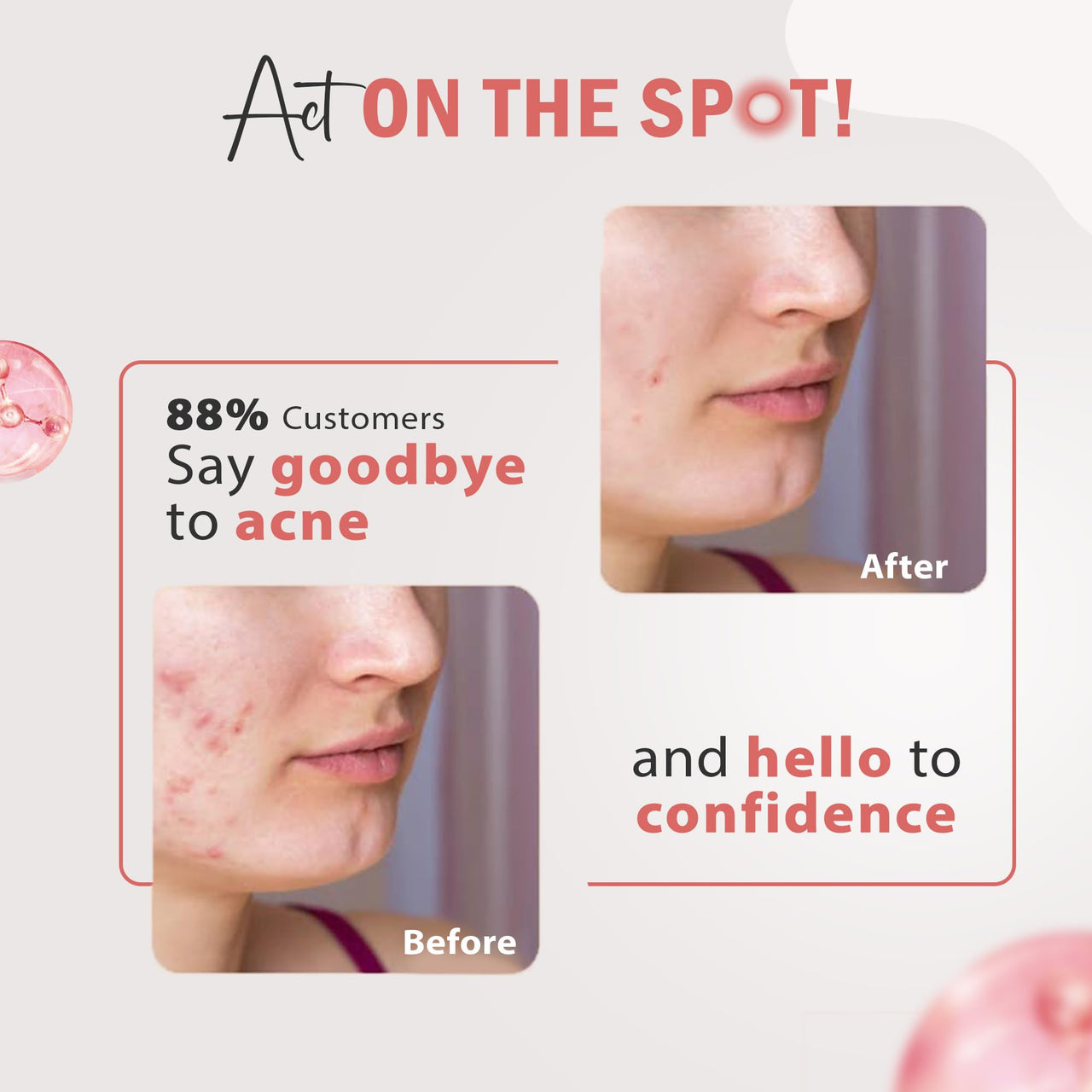 Glamveda 3% Kojic Acid Spot Corrector Gel Reduces Acne Scars & Dark Spots | Glow Booster & Pigmentation Removal | With Alpha Arbutin & Niacinamide | 20g