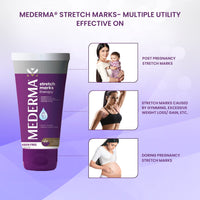 Mederma Stretch Marks Therapy | Stretch Mark Cream For Women & Men | Anti stretch mark cream during & After pregnancy (25g)