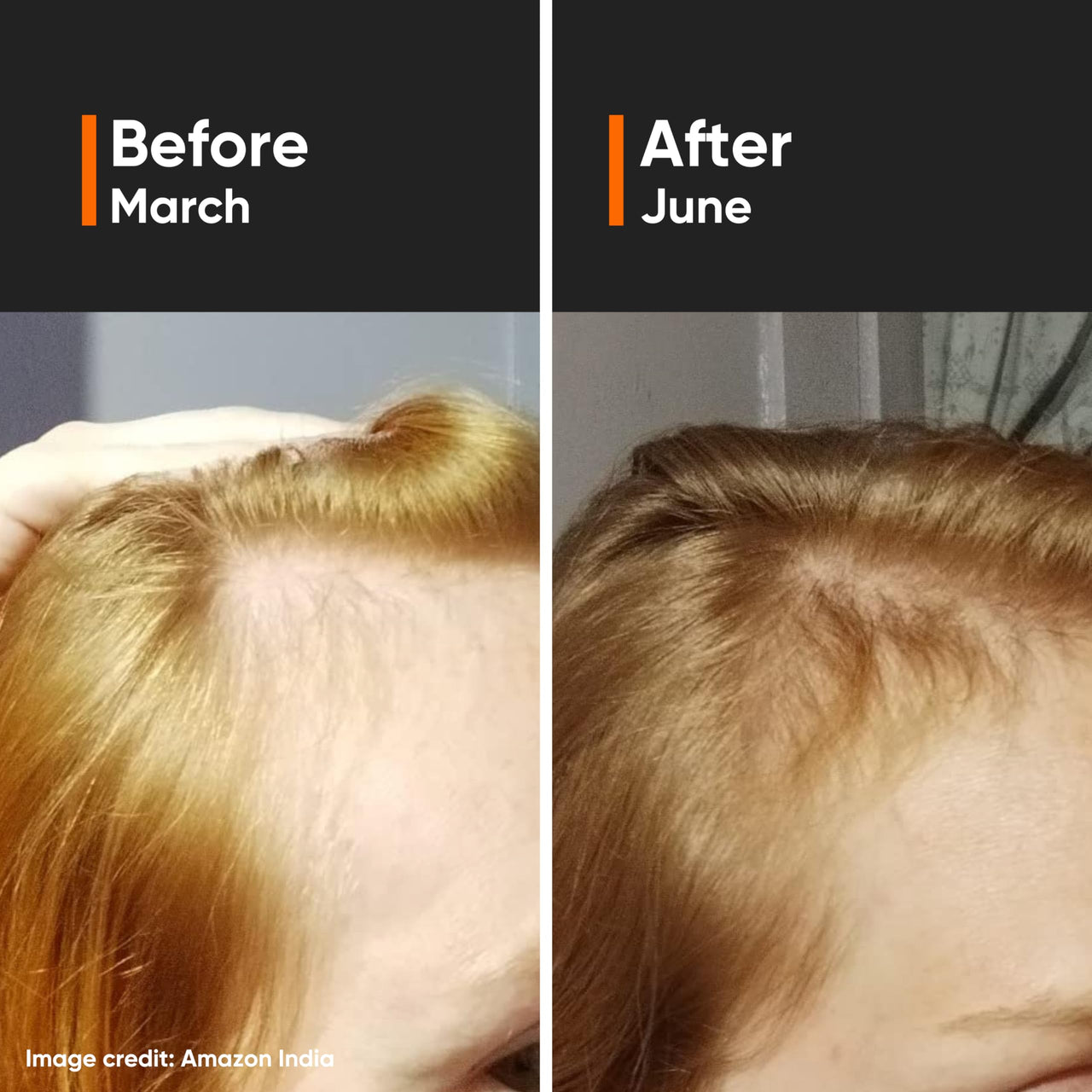 Minimalist Hair Growth Serum With 3% Redensyl, 3% Anagain, 3% Procapil, 5% Capixyl & 4% Baicapil 18% Hair Growth Actives | For Hair Fall Control | For Men & Women | 30 ml