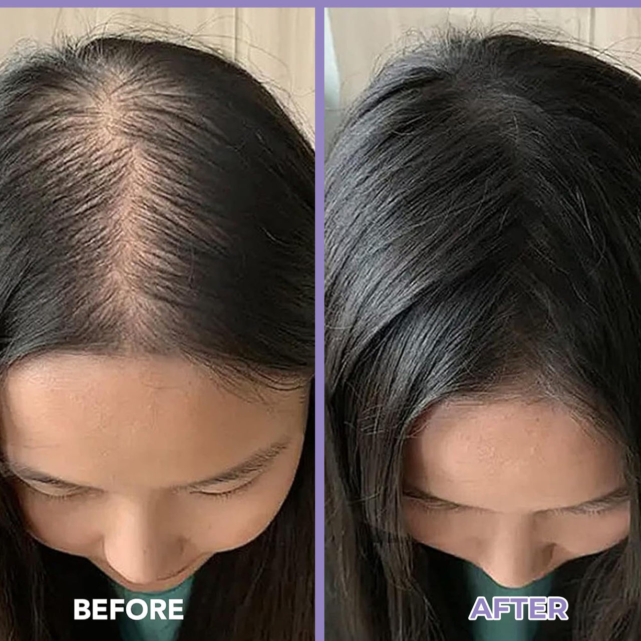SPRING H2O Rosemary Hair Oil – Promotes Thicker Hair | Nourishes, Strengthens Roots | 100% Natural Rosemary Oils Hair Fall Control – 200ml