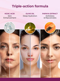 Kozicare Kojic Acid Soap & Papaya Face Wash Combo | Body Tan Removal Soap | Bathing Soaps for Glowing Skin -Pack of 3| Acne Wash for Glowing Skin l Gentle Exfoliating Face Wash For Men & Women-100Ml