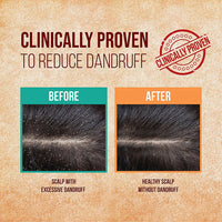 Indulekha Neemraj Oil, 50ML