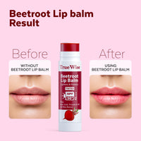 TrueWise® Tinted Lip Balm with SPF 50 PA+++ Brightening Beetroot Lip Balm For Dark Lips With Kojic Acid,Vitamin E, Soft, Glossy Lips- SPF lip balm for Women 5g (Pack Of 2)
