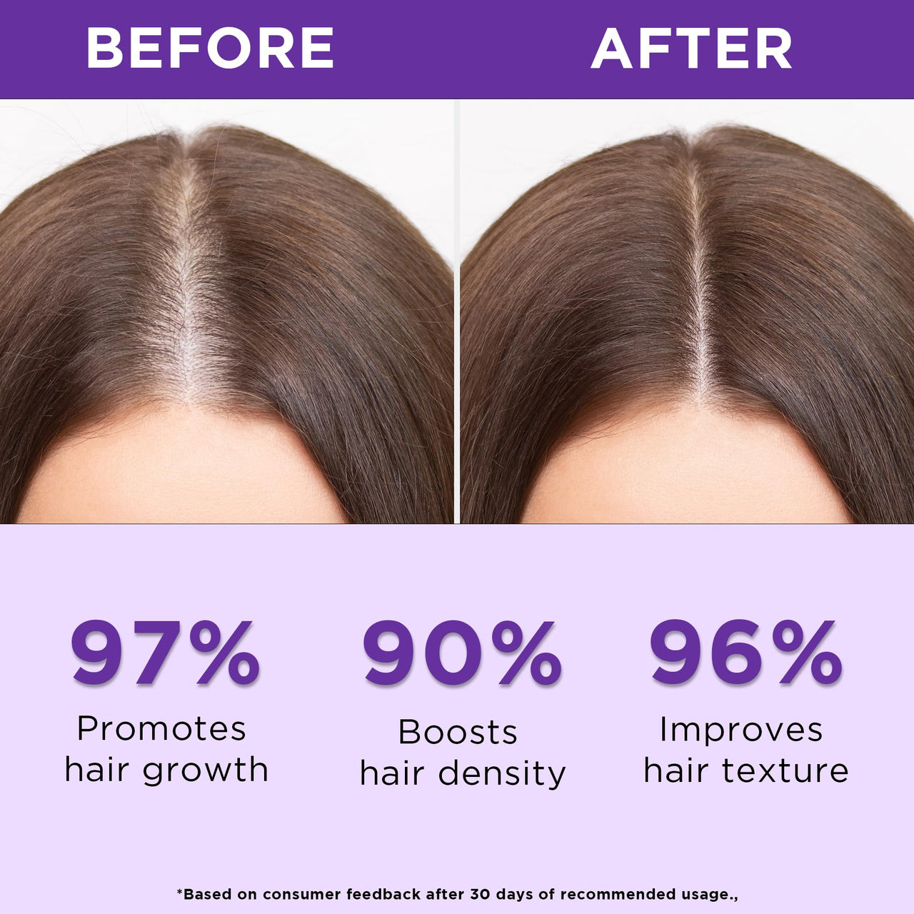 Orgatre Rosemary Water Spray for Hair Growth & Controls Hairfall with BIOTIN | Pure Natural Green Extraction Technologies | Controls Dandruff & Itchiness | Enhances Hair Texture & Shine | Non-Greasy & Fast Absorbing | 200 ml