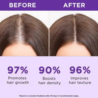 Orgatre Rosemary Water Spray for Hair Growth & Controls Hairfall with BIOTIN | Pure Natural Green Extraction Technologies | Controls Dandruff & Itchiness | Enhances Hair Texture & Shine | Non-Greasy & Fast Absorbing | 200 ml