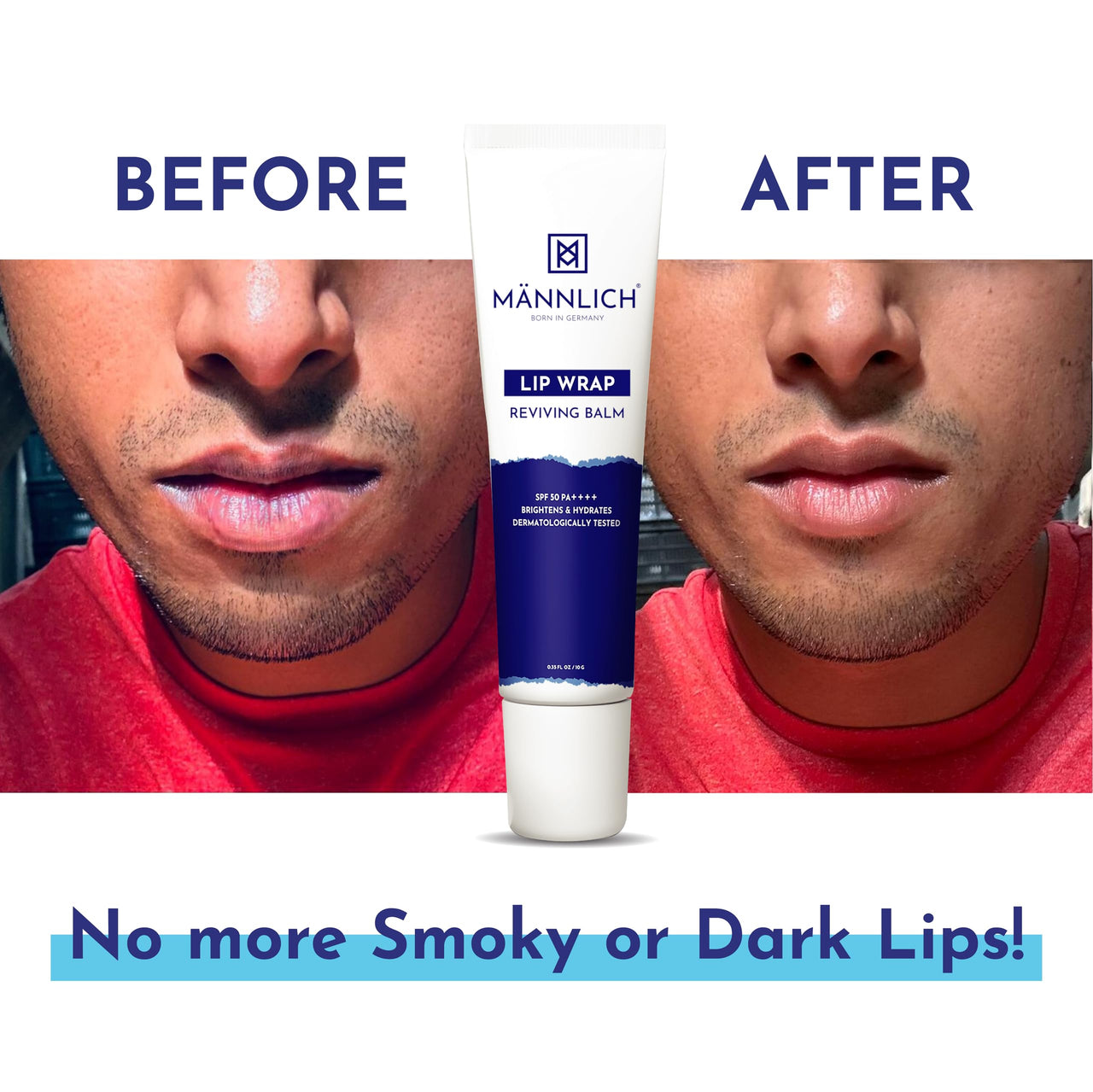 Mannlich Lip Balm For Men (10G) Lip Care With Spf 50 Pa++++ Protection - Lip Lightening For Dry & Chapped Lips - Moisturizes, Long-Lasting Hydration With 2% Kojic Acid & 1% Hyaluronic Acid, white