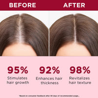 Orgatre Red Onion Water Spray for Hair Growth | 100% Natural Red Onion Extract with 17 Herbs | Hair Growth & Volume Booster | No Sticky Residue | 200ml