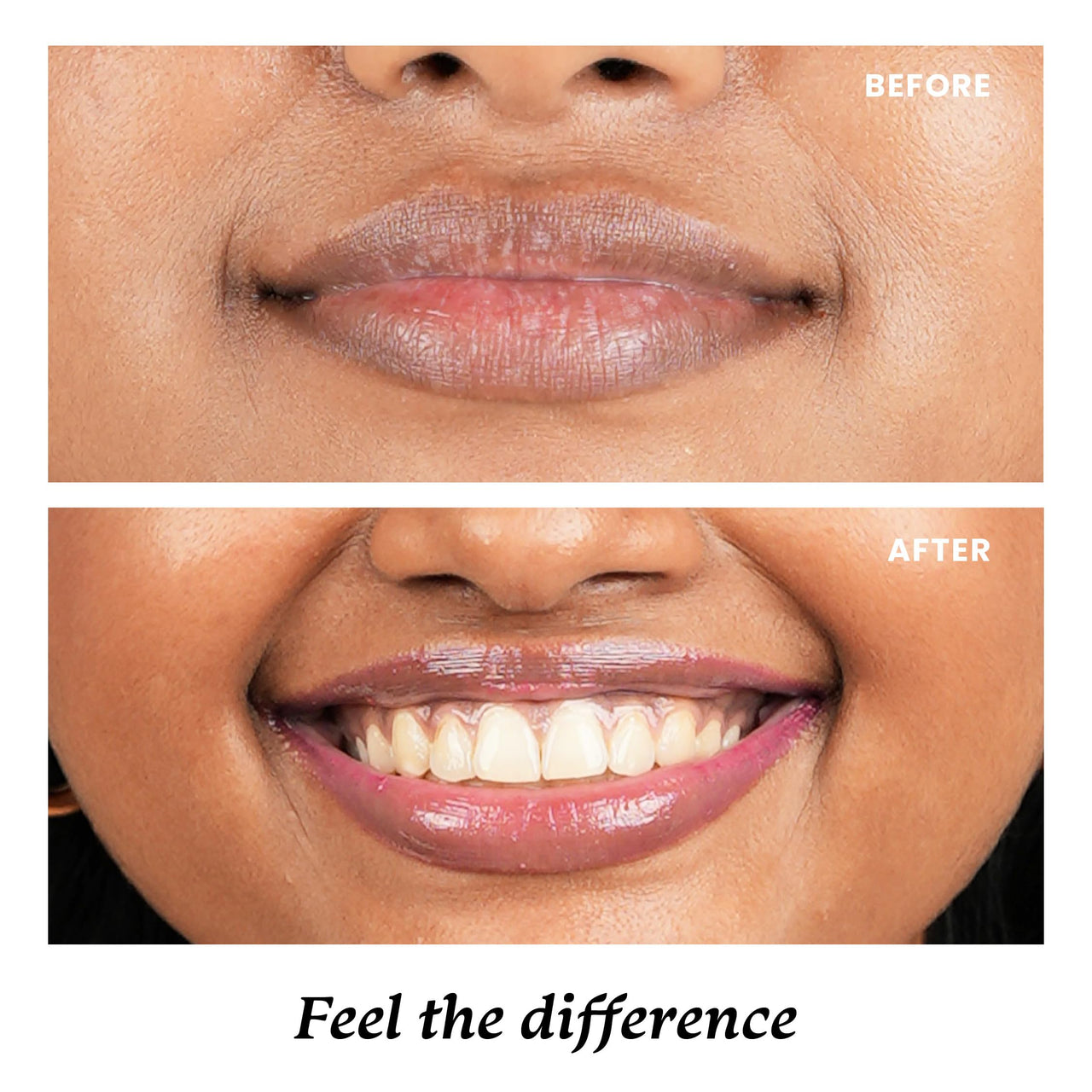 Foxtale SPF 30 Brightening Lip Balm for Dark Lips with Peptides & Vitamin C | Prevents Pigmentation | Brightens & Hydrates Lips | Tinted Lip Balm -Light Mauve Glaze 12gm