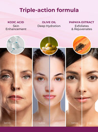 Kozicare Glutathione Soap & Kojic Acid Cream Combo | Body Tan Removal Soap | Bathing Soaps for Glowing Skin -Pack of 3 | Vitamin E & Niacinamide Cream | Face Cream For Women & Men-15gm