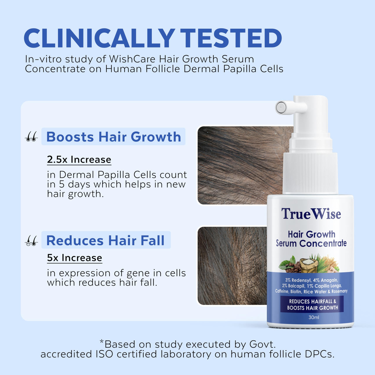 TrueWise® Hair Growth Serum 4% Anagain,3% Redensyl,2% Baicapil,1% Capilia Longa, Caffeine,Biotin & Rice Water With Rosemarry Advanced Hair Growth for Hair Fall Control Hair Serum for Women & Men 30ml