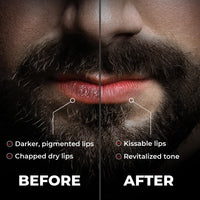 Beardo Lip Lightener for Men, 7g | Non Tinted Lip Balm for Men | Lip Balm for Dark Lips | Lip Mask for Dry & Chapped Lips | Lip Care for Smooth, Soft & Pink Lips