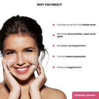 ThriveCo Goodbye Acne™ Facial Cleanser | Reduces Acne, & Sebum | Diacnemide™,| Nondrying & Moisturising | Women & Men, 25ml