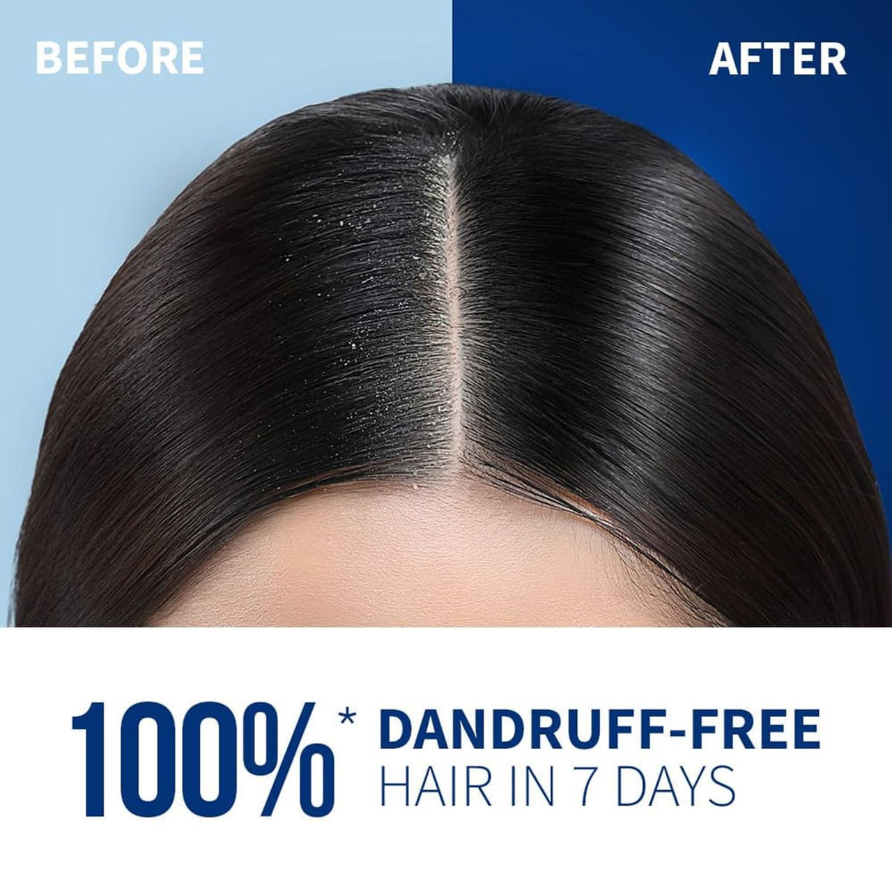 TryOnes Pre Botic Shampoo Damage Repairing your Hair Cuticle & Giving Frizz Control - Premium Hair Care 1000 ml