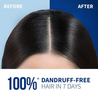 TryOnes Pre Botic Shampoo Damage Repairing your Hair Cuticle & Giving Frizz Control - Premium Hair Care 1000 ml