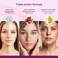 Kozicare Kojic Acid Cream | Tan Removal Cream | Whitening Cream | Detan Cream | Face Cream for Women & Men | Glutathione Cream | Day Cream for Women Daily Use - 6 Tube Pack (7 Gm Each)