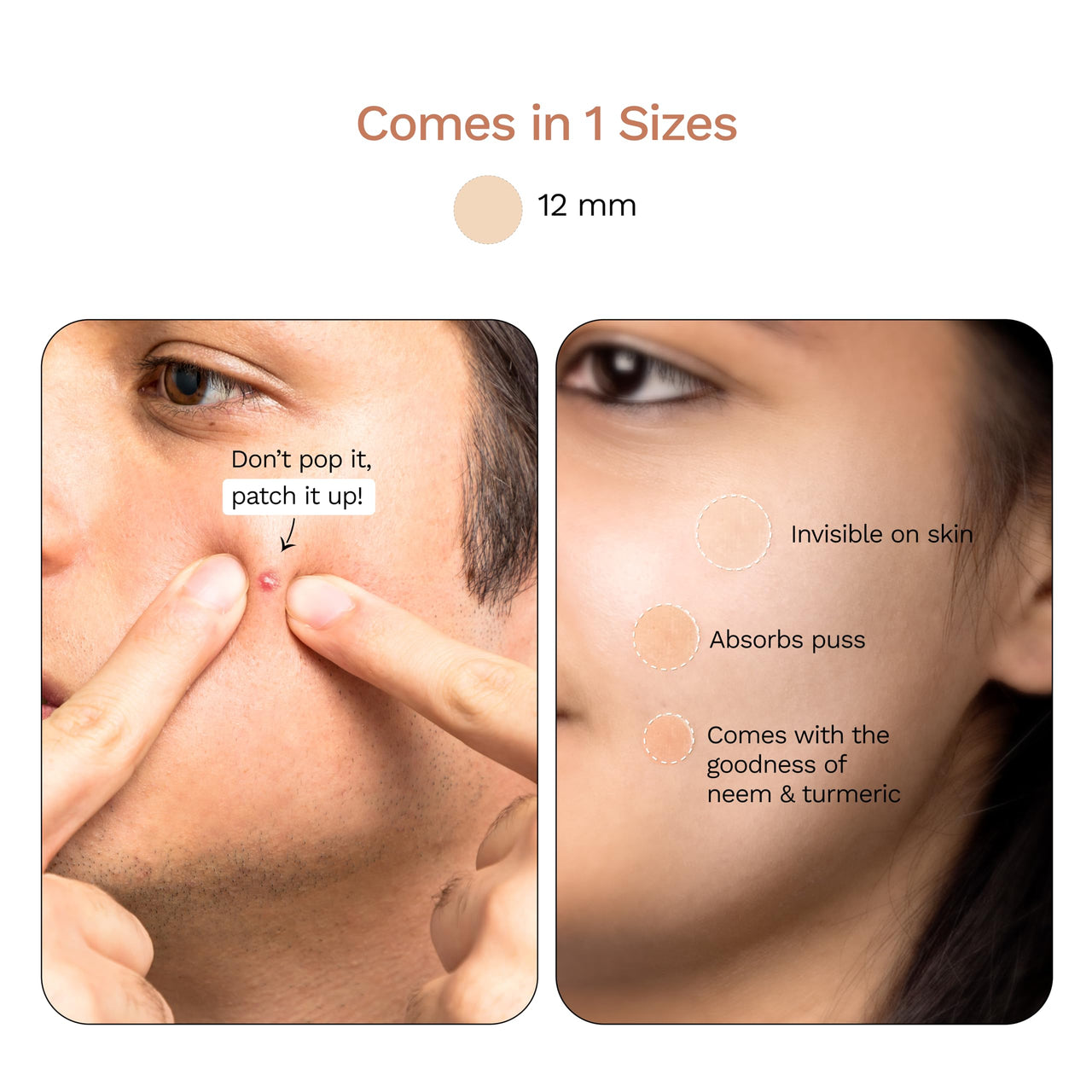 FURR by Pee Safe Acne Patches For Pimples | 12 Hydrocolloid Acne Relief Patches - 3 Sizes | Made with Ayurvedic Ingredients | Anti Inflammatory | Reduces Acne, Spots and Blemishes