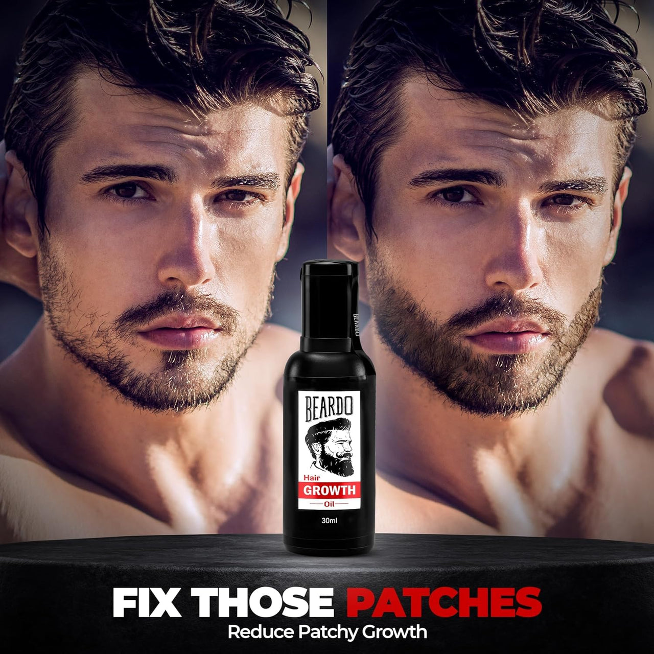 Beardo Beard & Hair Growth Oil, 30ml | Natural Hair Oil for Thicker & Longer Beard | Beard Oil for Uneven, Patchy & Fast Beard Growth | Growth Oil for Stronger & Fuller Beard Hair
