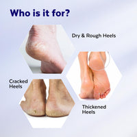 TrueWise® 20% Urea Crack Heel Repair Foot Cream Roll On 50ml Foot Cream For Dry And Cracked Feet With 2% Lactic Acid, Olive Oil & Vitamin E | Help Heel Repair and Moisturise Cracked Heels (2)