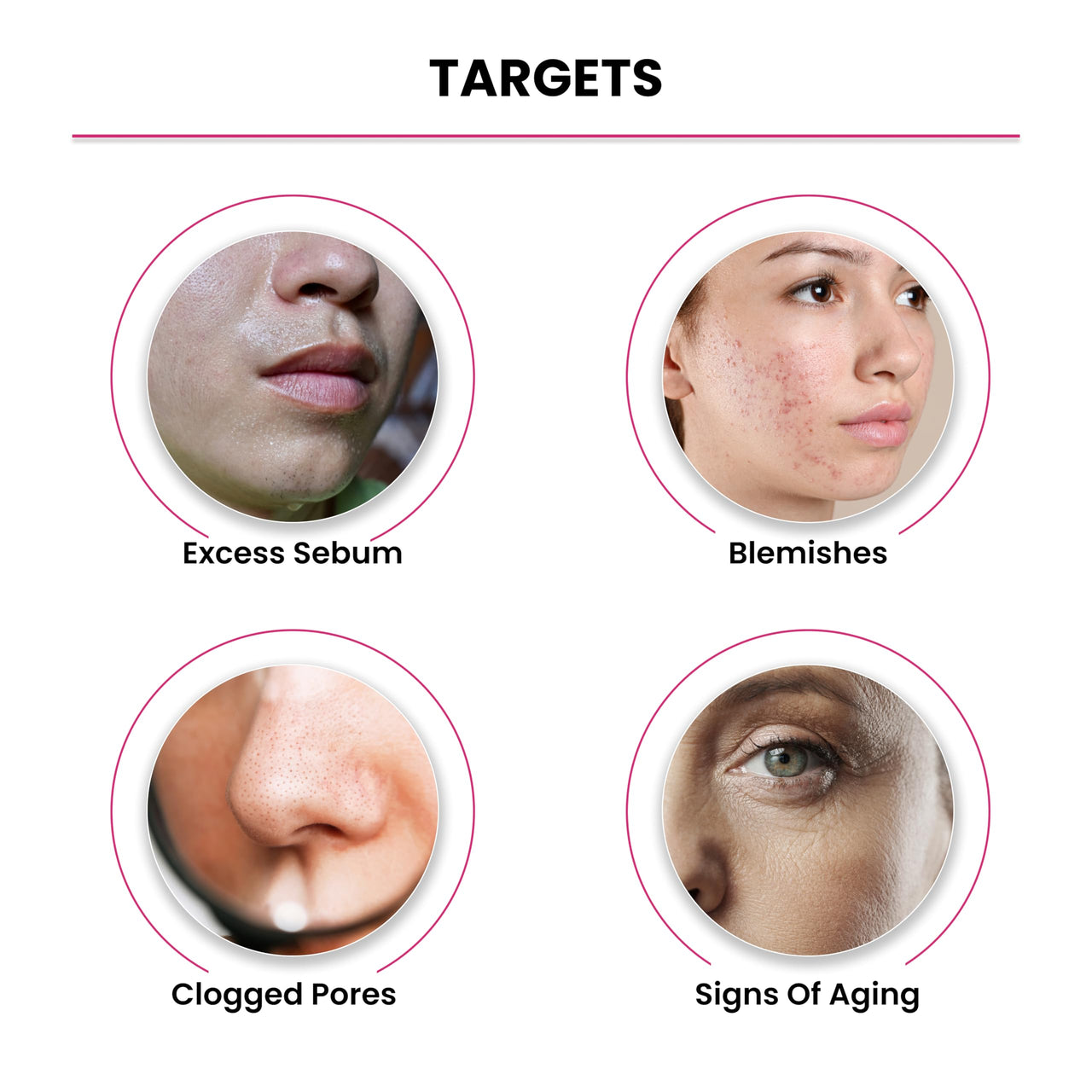 Thriveco 10% Niacinamide Face Serum + 1% Zinc Pca for Clear Glowing Skin | Reduction of Acne | Men & Women, 30ml