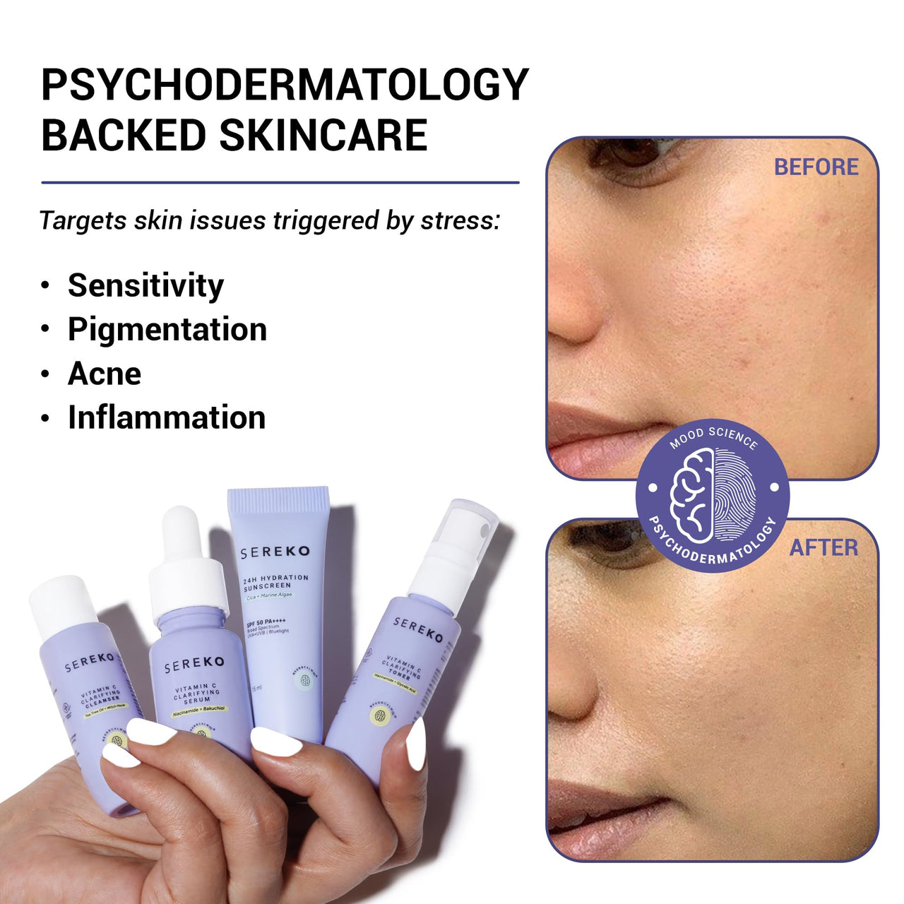 Sereko Bestseller’s Skincare Trial Kit | Vitamin C, Niacinamide & Cica | Brightening & Hydrating Set for Women & Men | Pack of 4 | Self-Care For Glowing Skin | Travel & Pocket Friendly