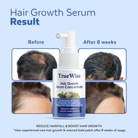 TrueWise® Hair Growth Serum 4% Anagain,3% Redensyl,2% Baicapil,1% Capilia Longa, Caffeine,Biotin & Rice Water With Rosemarry Advanced Hair Growth for Hair Fall Control Hair Serum for Women & Men 30ml