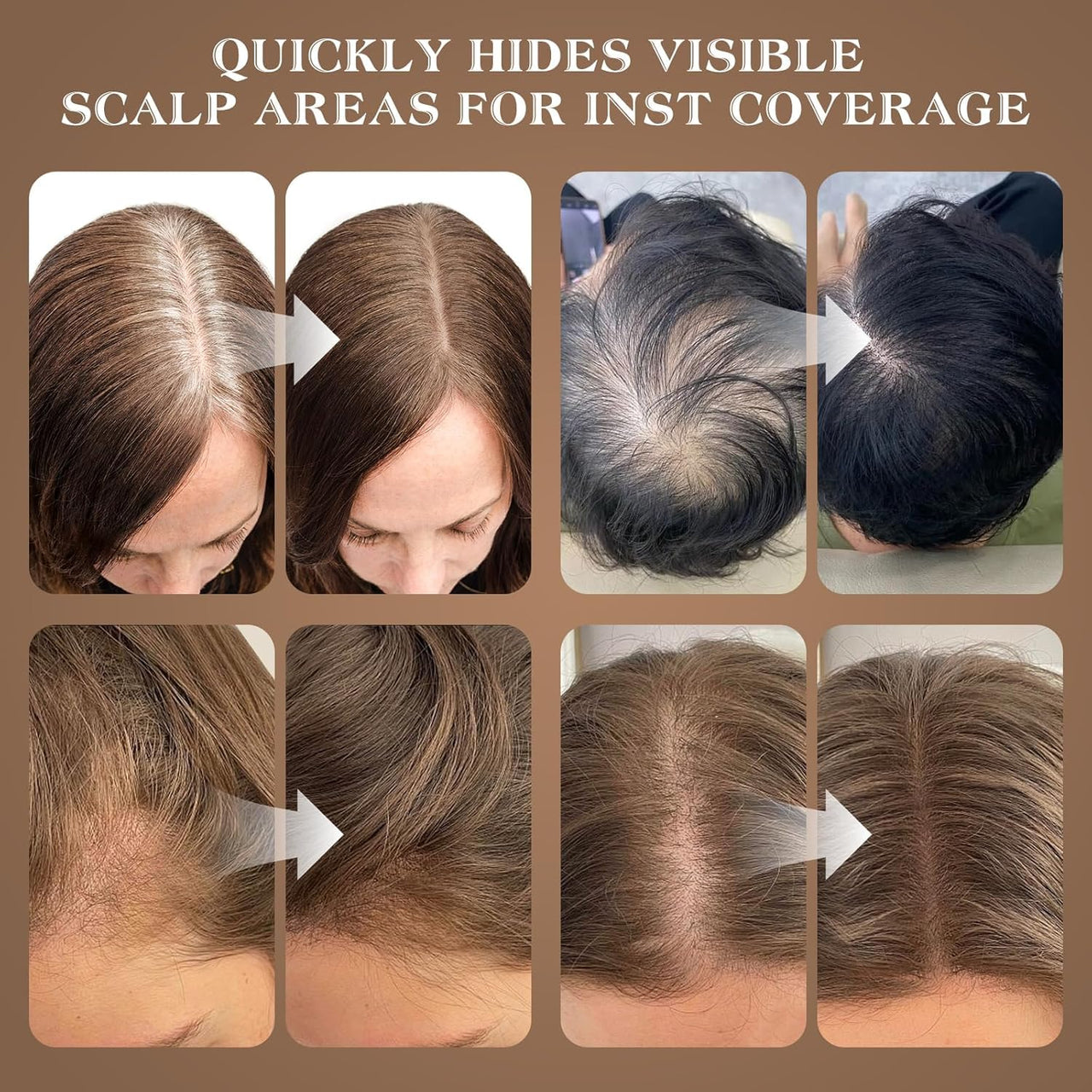 VETMOC Cover-Up Hair Powder- Black, Helps Cover Grey Roots & Bald Spots Instantly, Highly Pigmented, Fuller and Denser, Long-Lasting & Matte Finish, Super-Fine Powder for Flawless Application, 4gm