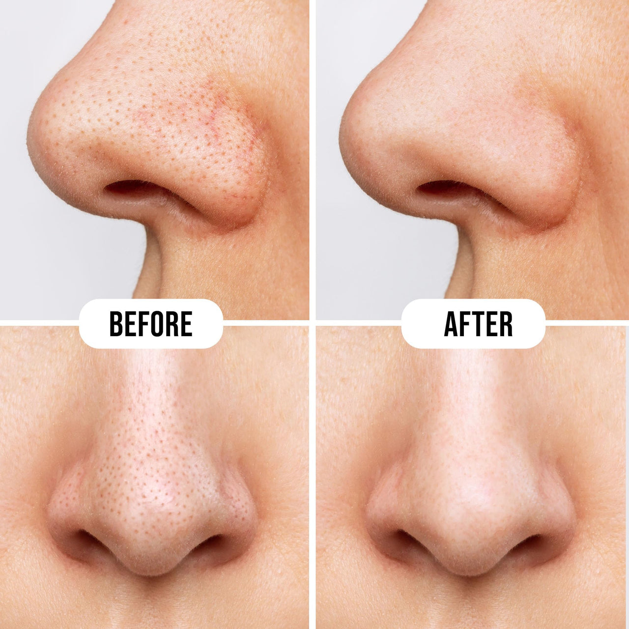 Hilary Rhoda Deep Cleanse Nose Strips | Instant Removal | Removes Blackheads & Whiteheads | Deep Cleanses Skin & Removes Dirt & Oil | 10 Strips (Charcoal - Shade 01)