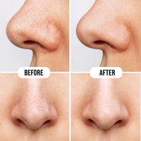 Hilary Rhoda Deep Cleanse Nose Strips | Instant Removal | Removes Blackheads & Whiteheads | Deep Cleanses Skin & Removes Dirt & Oil | 10 Strips (Charcoal - Shade 01)