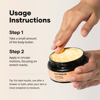 Cureskin Smoothing Body Butter Stretch Marks Cream for Women and Men | Stretch Marks Removal Cream for Women