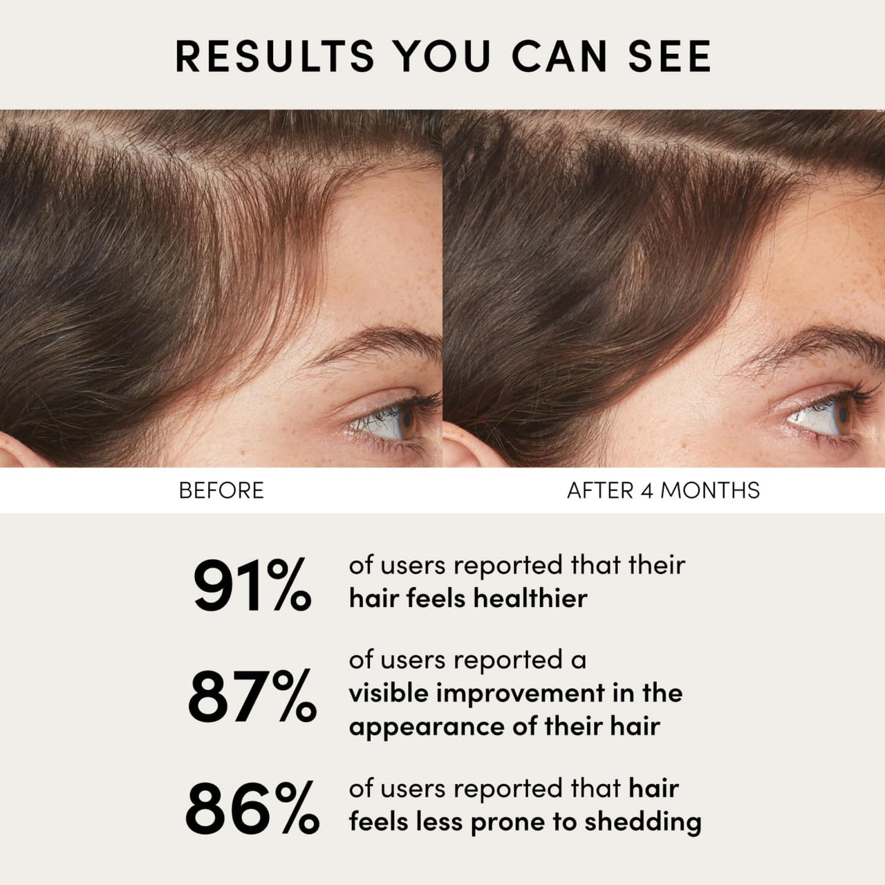 Ravel Advanced Hair Serum | 2.5% Capilia Longa + 3% Anagain + 2% Redensyl + 2% Adenosine, Rosemary & Pumpkin Seed | Promotes Hair growth | Hair Serum for Men & Women | 30ml