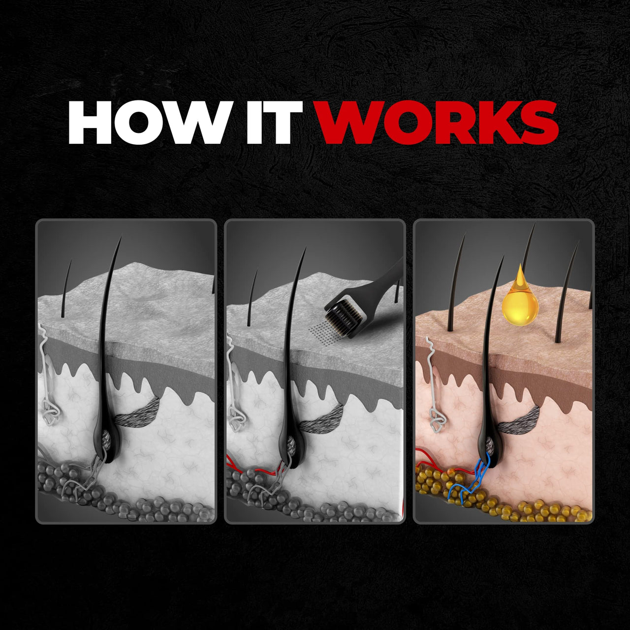 Beardo Beard & Hair Growth Oil 50ml & Derma Roller For Hair Growth 0.5 mm| Dermaroller | For Thicker & Longer Beard | Uneven, Patchy & Fast Beard Growth | For Stronger & Fuller Beard Hair