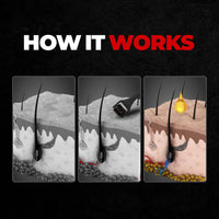 Beardo Beard & Hair Growth Oil 50ml & Derma Roller For Hair Growth 0.5 mm| Dermaroller | For Thicker & Longer Beard | Uneven, Patchy & Fast Beard Growth | For Stronger & Fuller Beard Hair