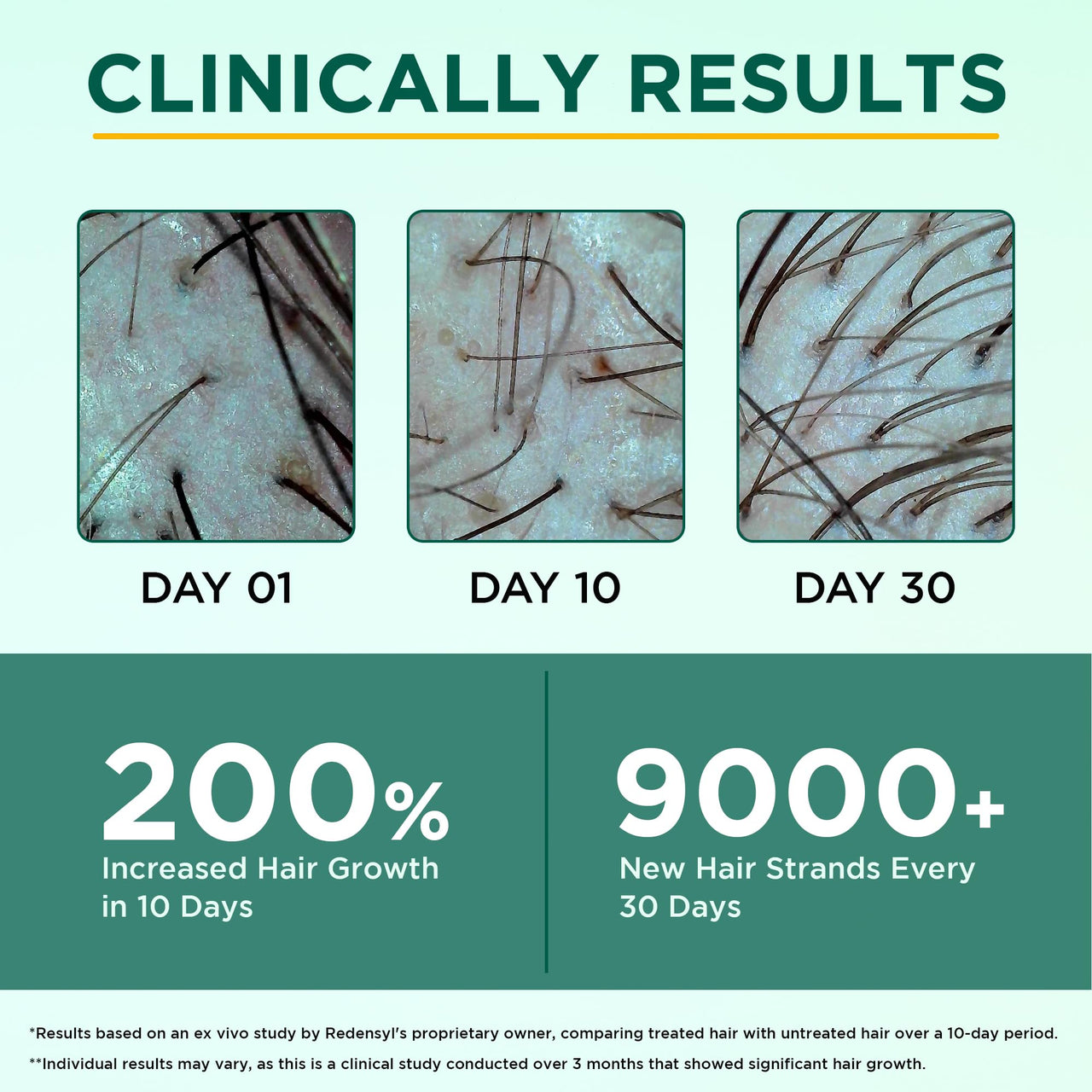 ORGATRE Hair Growth Serum for scalp - 50ml | 3% Redensyl, 4% Anagain, 3% Procapil, 1% Capilia Longa & Rosemary Oil | Scalp Treatment & Hair Tonic for Men & Women | Effective Hair Regrowth Formula