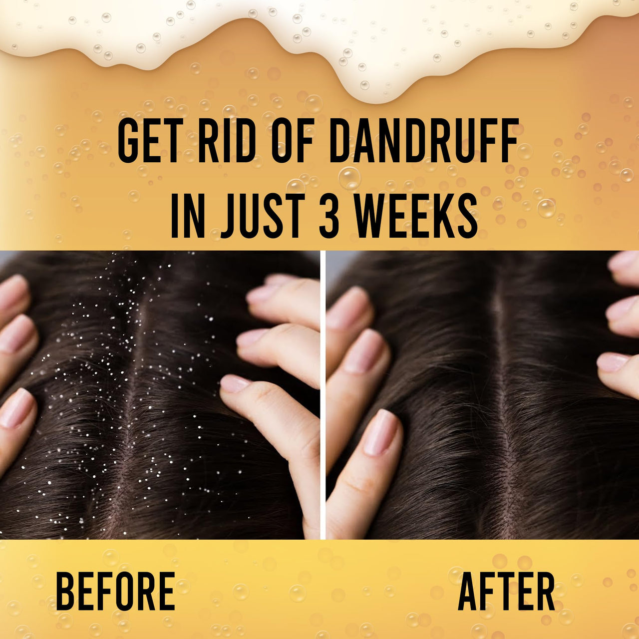 TRYONES Beer Anti-Dandruff Shampoo | Removes Dandruff From Source | Helps With Itching, Irritation & Redness Accompanying Dandruff | For Women & Men | 1000Ml