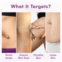 Conscious Chemist® Retinol Body Cream | Reduces Stretch Marks, Uneven Skin Tone & Scars | For Post Pregnancy Irregular Lines/Streaks | All Skin Types, Fragrance Free & Cruelty Free | 100 g