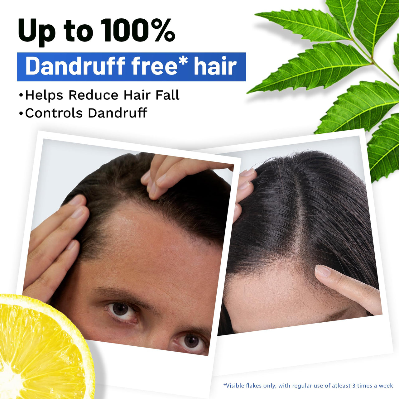 SESA Ayurvedic Anti Dandruff Shampoo With Neem, Lemon Helps Reduce Hairfall Controls Dandruff, 500Ml