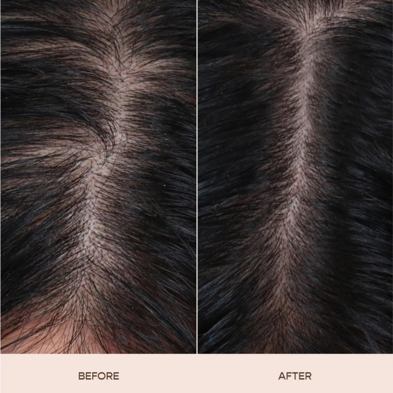 Ravel Advanced Hair Serum | 2.5% Capilia Longa + 3% Anagain + 2% Redensyl + 2% Adenosine, Rosemary & Pumpkin Seed | Promotes Hair growth | Hair Serum for Men & Women | 30ml