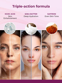 Kozicare Kojic Acid Soap & Saffron Face Cream Combo | Body Tan Removal Soap | Body Soap for Women & Men- Pack of 3 | Alpha Arbutin & Niacinamide Cream | Reduces Dark Spots and Enhances Glow-15gm