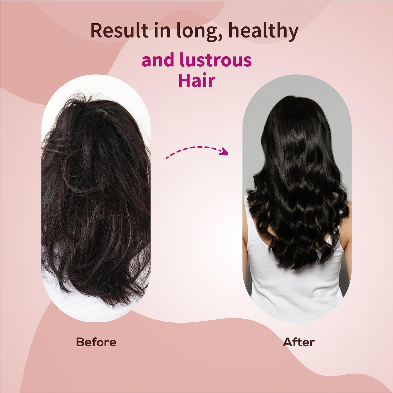 Ayouthveda Anti-hairfall Shampoo | Salfate & Paraben Free | Prevents Dandruff & Itchi Scalp | Cleanse, Conditions & Purifies Hair & Scalp | Improve Hair Density & Texture (Pack Of 5-200ml each)