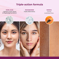 Kozicare Kojic Acid Soap & Papaya Body Lotion Combo | Body Tan Removal Soap | Bathing Soaps for Glowing Skin -Pack of 3 | Shea Butter Body Lotion | Niacinamide & Vitamin E Moisturizer For Body - 200Ml