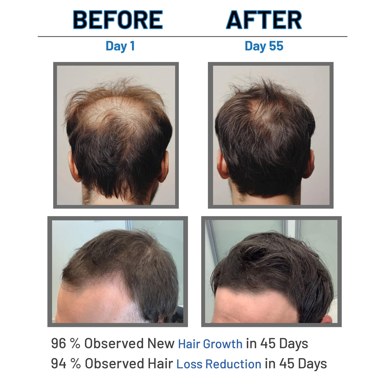 LUMOSIQUE® Hair Growth Serum helps to Hair Fall Control & Hair Growth - 30ml