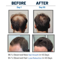 LUMOSIQUE® Hair Growth Serum helps to Hair Fall Control & Hair Growth - 30ml