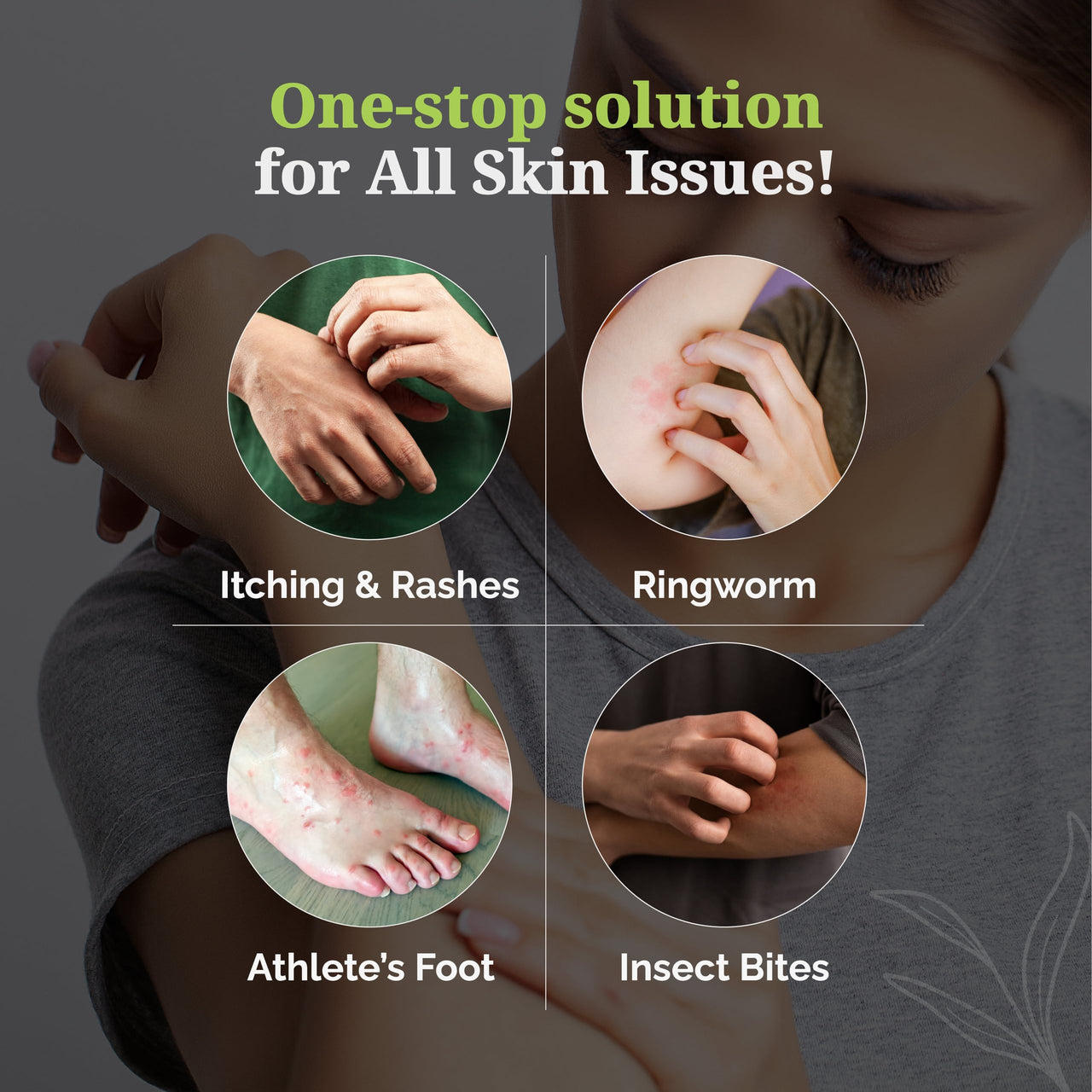 Itchstop® Anti-Fungal Spray | Hands Free | Instant Relief from Itching, Ringworm, Eczema, Redness, Chafing, Jock Itch, Athlete's Foot | Ayurvedic, Safe for Men & Women, Daily Use, 35ml - Pack of 2