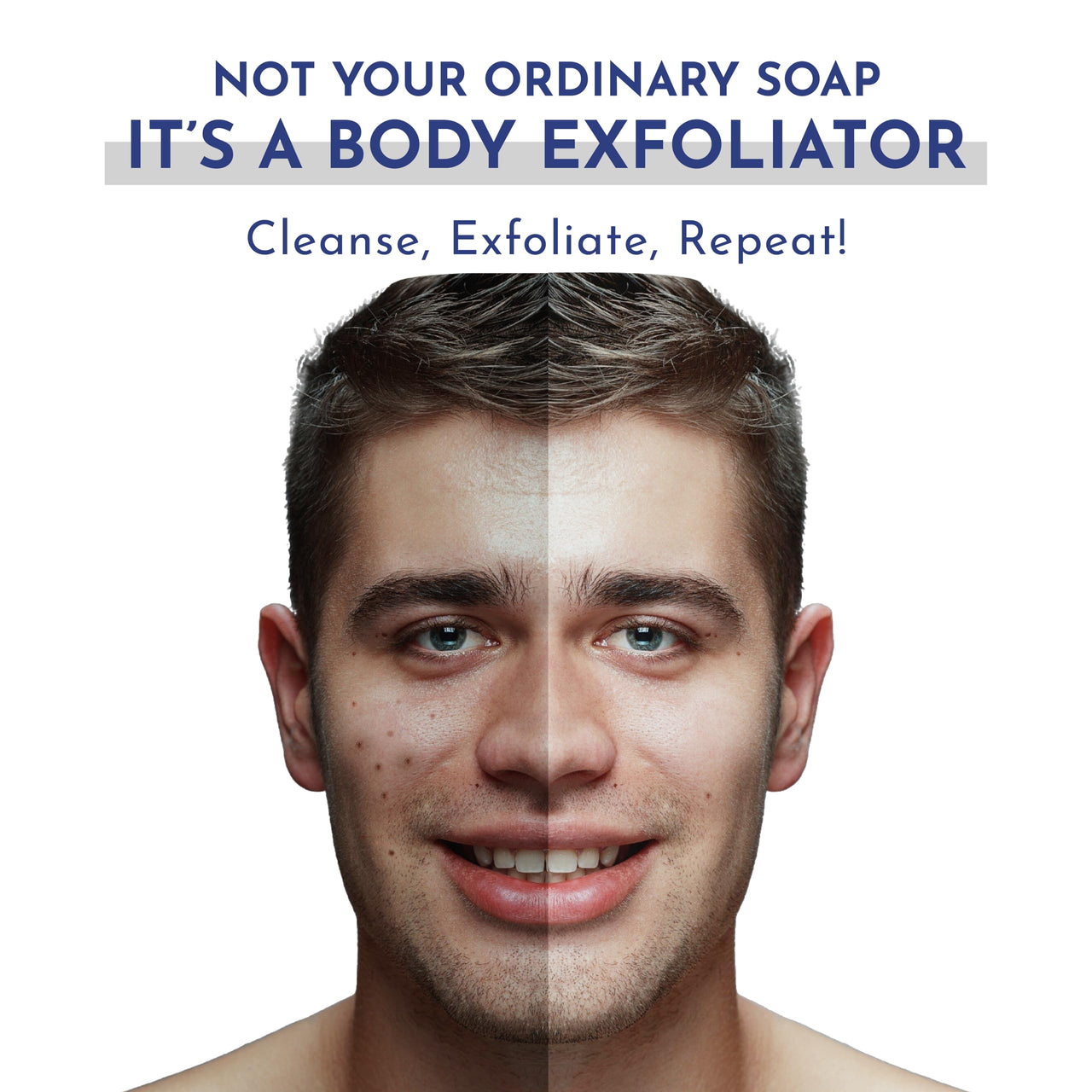 Mannlich Anti-Acne Soap | Controls Excess Sebum | Handmade Body & Face Soap for Acne-Prone and Oily Skin | 2% Salicylic Acid, 2% Niacinamide & 2% Tea Tree Oil | Brightens Skin, Fades Dark Spots | Prevents Body Acne | pH Balanced, SLS Free, Dermatologicall