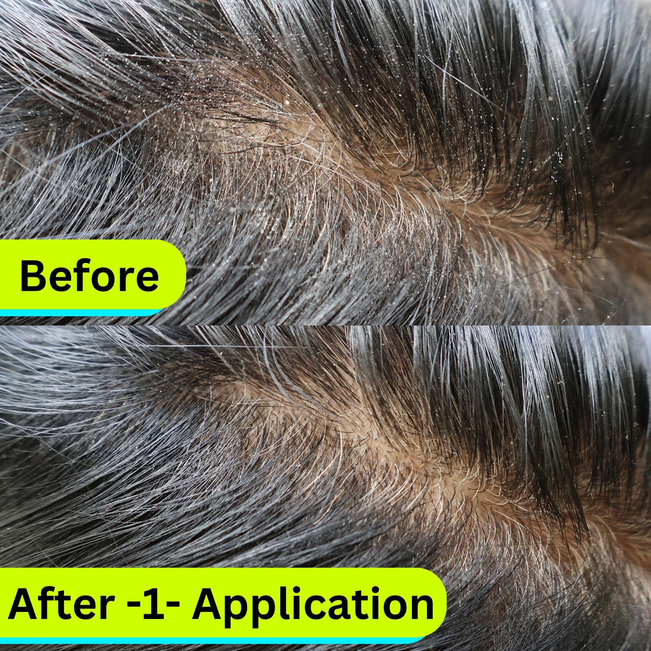 NOX DETOX Anti Dandruff Hair Mask | Overnight Solution for Dry, Itchy, Flaky Scalp | 100% Vegan | Paraben Free