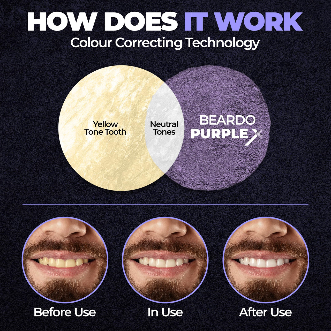 Beardo PurpleX Teeth Whitening Powder, 50g | Stain Removal and Teeth Whitening Solution | Enamel Safe | Prevents Bad Breath | With Papain and Bromelain Enzymes for Stain removal | Peroxide Free