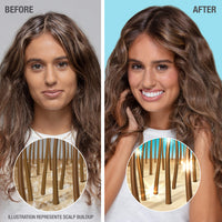 Neutrogena Moisturizing Healthy Scalp Hydro Boost Shampoo for Dry Hair and Scalp, with Hydrating Hyaluronic Acid, pH-Balanced, Paraben & Phthalate-Free12 fl oz