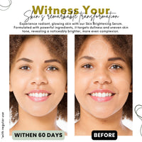 Nature's Kinn Pure Radiance Lightening & Brightening Serum 30 ml | Enhanced with Licorice, Niacinamide, Cactus Stem Cells, and AHA | Free of Alcohol, Sulphates, Parabens, and Phthalates | Hydrating, Skin-Brightening Serum