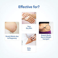 The Moms Co. Natural Body Butter (200g) for Stretch Marks, Dry Skin and Itchy Skin with Shea and Cocoa Butter